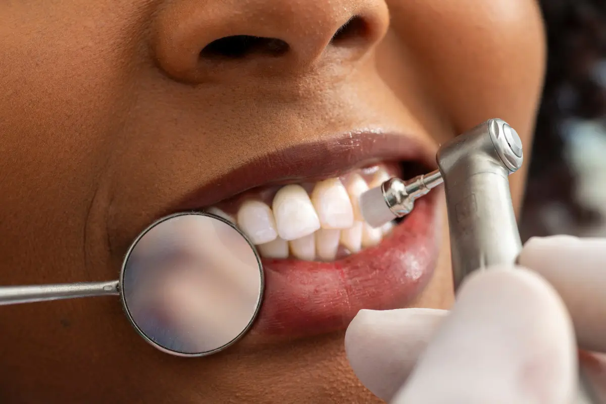 Dental Hygiene