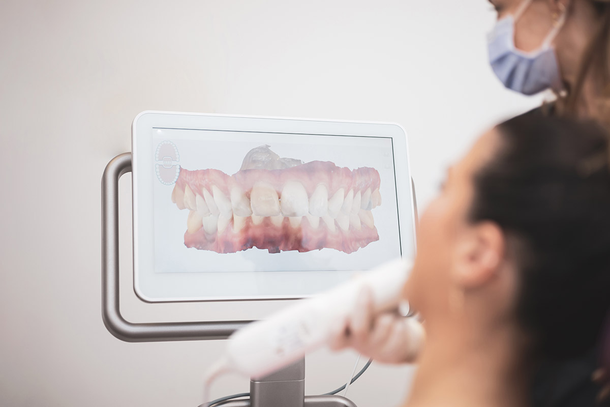 Same-Day-Crowns-Service-img